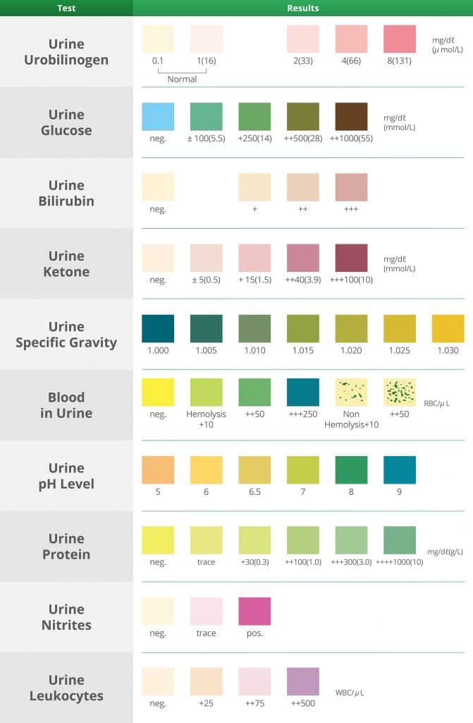 urine color chart whats normal and when to see a doctor nurse study ...