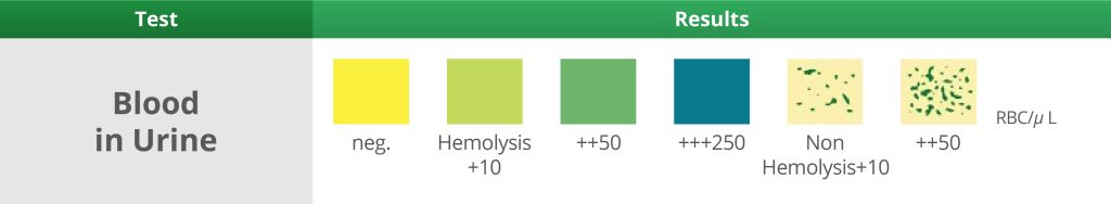 What Does Each Part of the Dipstick Test Mean? - StarMed Specialist Centre